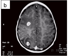 Sagittal_T1_WI_B